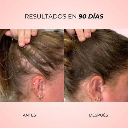 Aura Hair™ | Cepillo de Fototerapia LED y Estímulo Capilar Activo