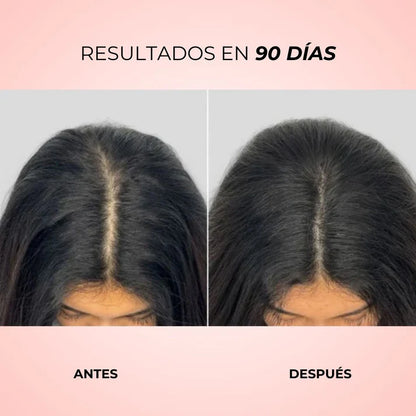 Aura Hair™ | Cepillo de Fototerapia LED y Estímulo Capilar Activo